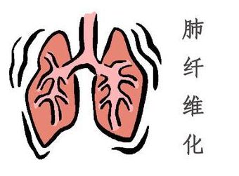 清肺仪治疗肺纤维化